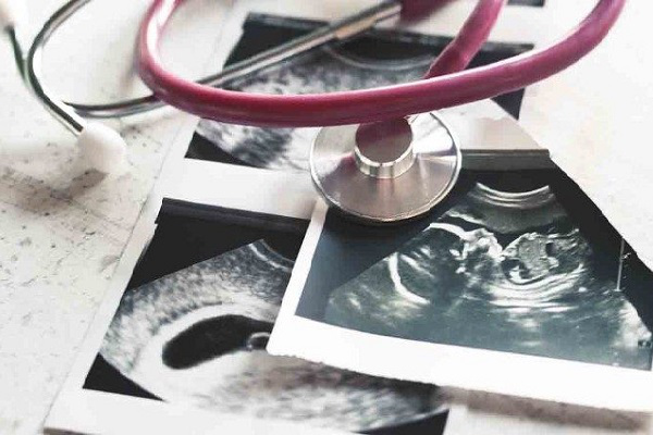 Các giám mục Pháp đau buồn khi quyền phá thai được đưa vào Hiến pháp nước này